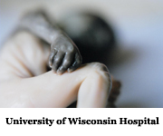 U of WI Hospital