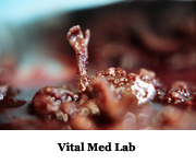 Vital Med Lab